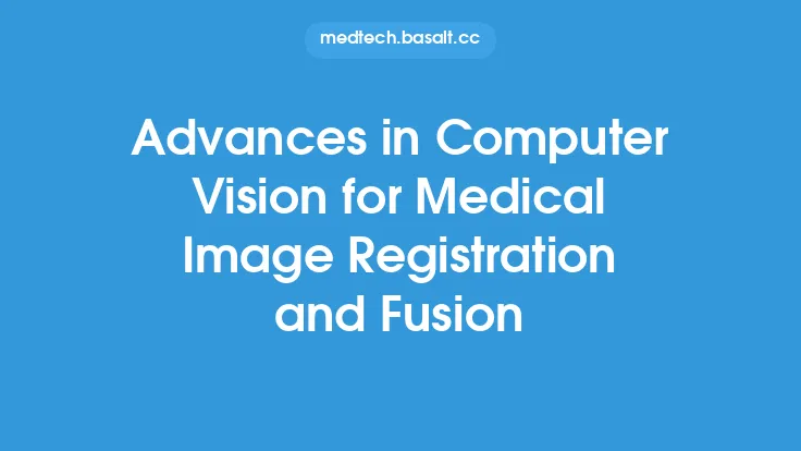 Advances in Computer Vision for Medical Image Registration and Fusion Thumbnail
