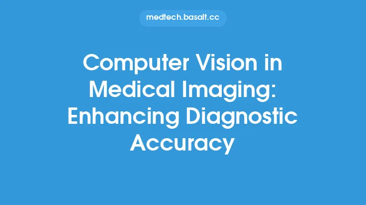 Computer Vision in Medical Imaging: Enhancing Diagnostic Accuracy Thumbnail
