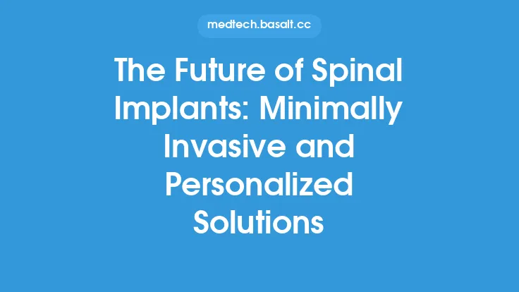 The Future of Spinal Implants: Minimally Invasive and Personalized Solutions Thumbnail