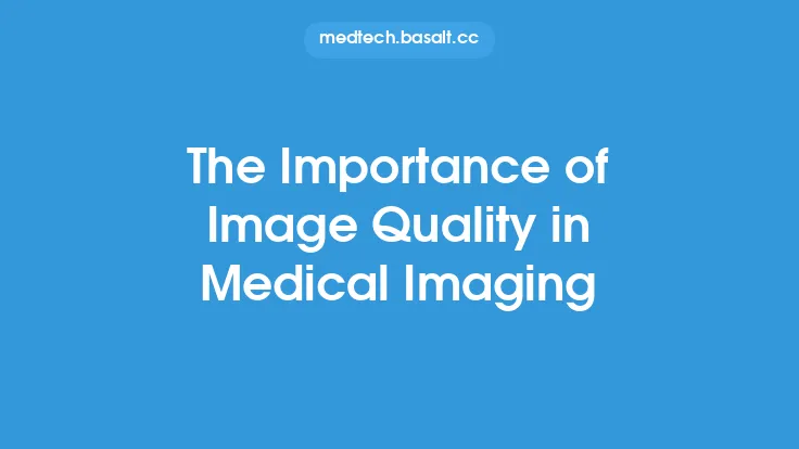 The Importance of Image Quality in Medical Imaging Thumbnail